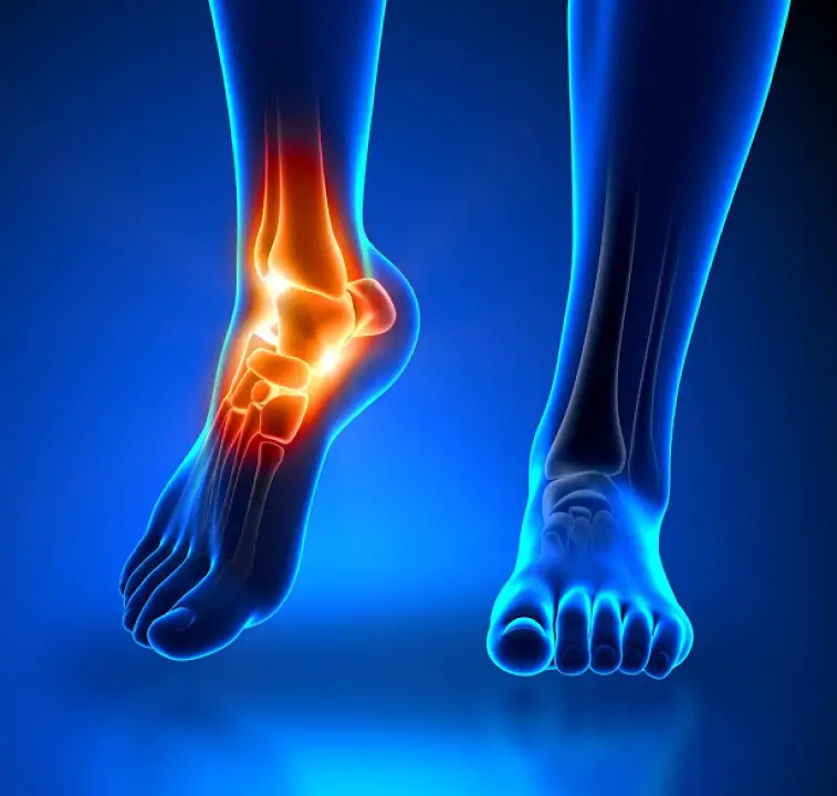 clinica-de-lesiones-deportivas-lesiones-de-tobillo-especialistas-en-lesiones