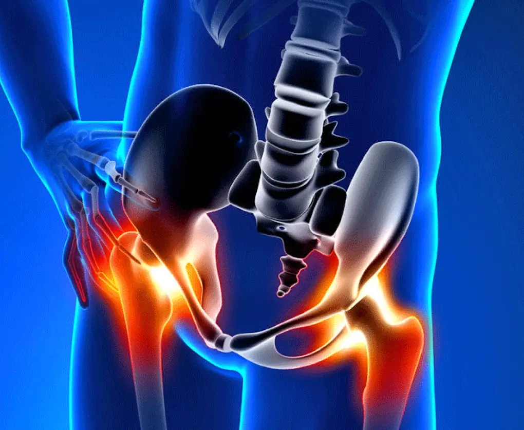 coxalgia | Clínica de Lesiones Deportivas clinica-de-lesiones-deportivas-cadera-tratamientos-roboticos