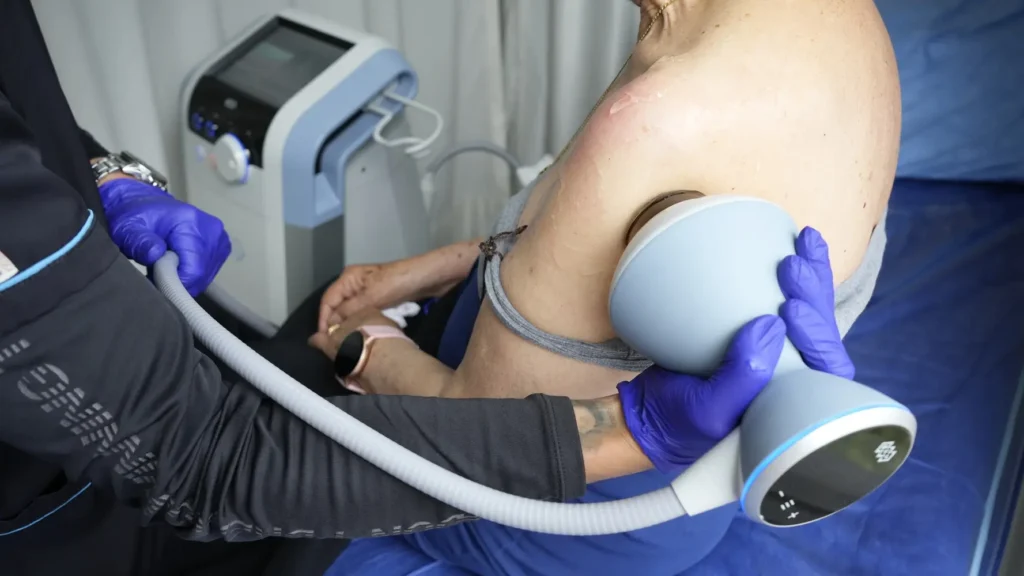 que es una luxacion | Clínica de Lesiones Deportivas ondas de choque - evita cirugias paciente