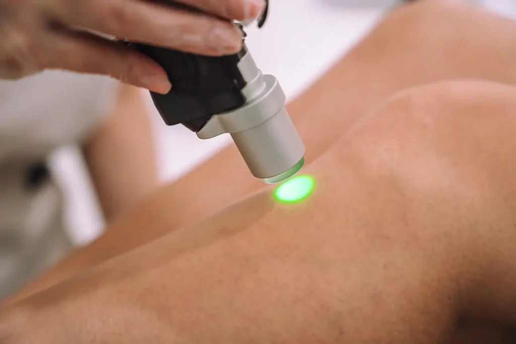 Aplicación de láser de alta intensidad en rodilla inflamada- clinica de sobrepreso, obesidad y metabolismo