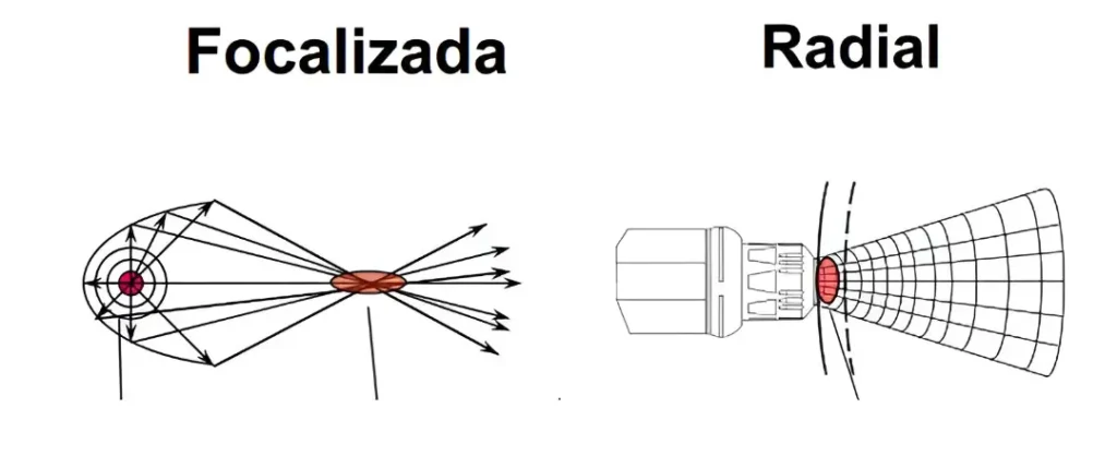Aplicaciones de ondas de choque focales en lesiones musculares profundas-clinica de lesiones deportivas