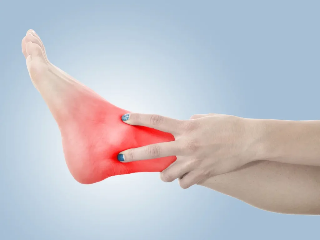 talon de aquiles | Clínica de Lesiones Deportivas Paciente realizando ejercicios excéntricos para el talón de Aquiles- clinica de lesiones deportivas