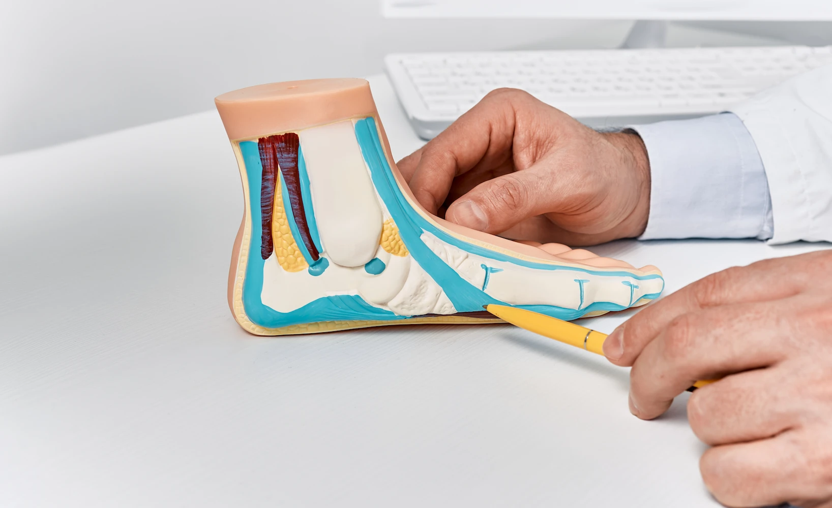 Anatomía del pie mostrando tipos de pie plano - clinica de lesiones deportivas