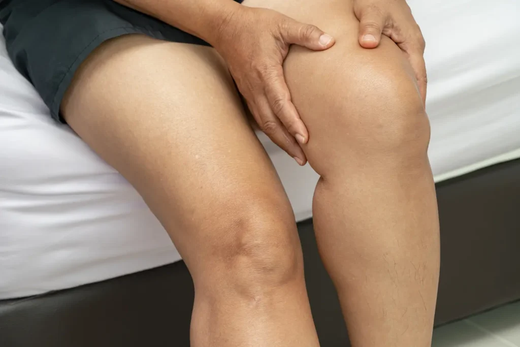 tratamiento para la retención de líquidos - clinica de lesiones deportivas