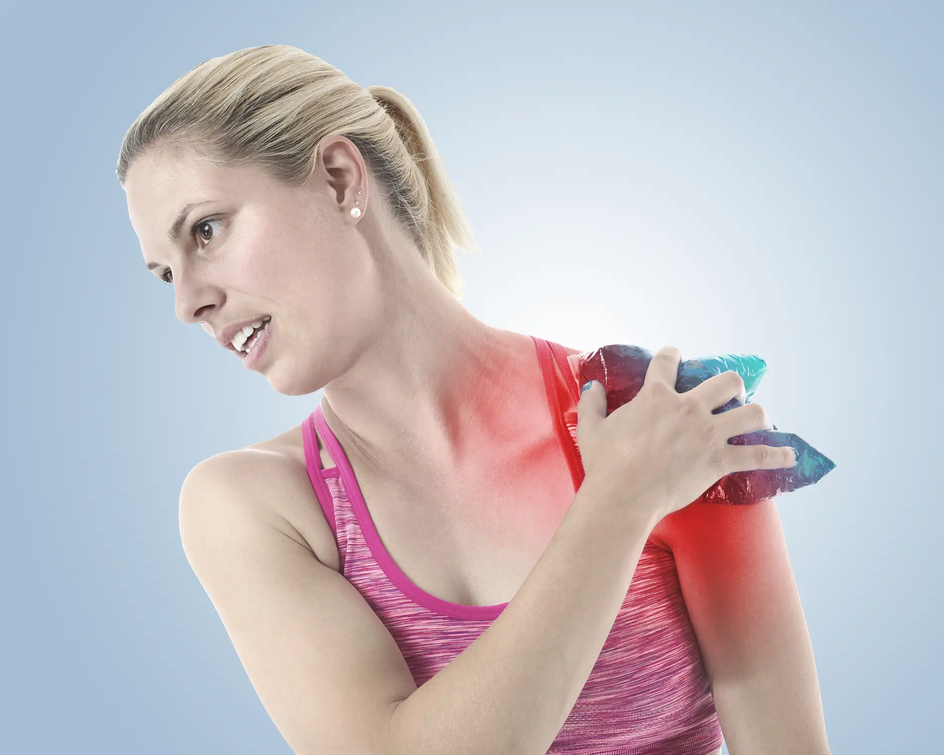 Imagen anatómica mostrando qué es una luxación en el hombro - clinica de lesiones deportivas